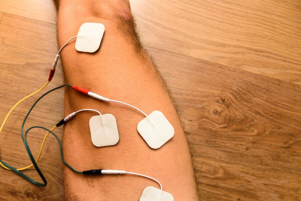 Electrodes of an electrostimulator on the leg of a male athlete.